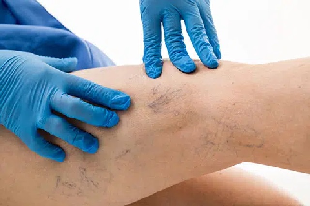 Consulta angiologista em Bras&iacute;lia &ndash; Core Centro M&eacute;dico