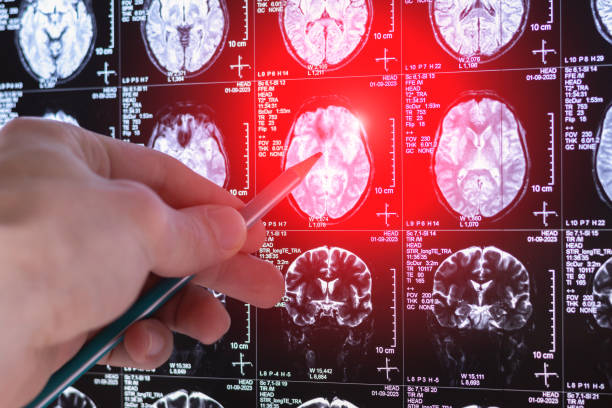 Consulta neurologista em Bras&iacute;lia &ndash; Core Centro M&eacute;dico